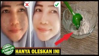 Rahasia Ampuh Menghilangkan Flek Hitam