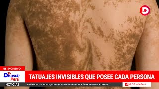 Los 'tatuajes' invisibles que posee cada persona desde el nacimiento