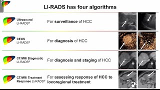 P4 LIRADS CT/MRI DIAGNOSTIC ALGORITHM: ACR LIRADS COMMITEE