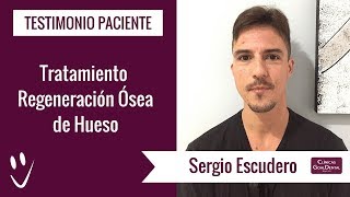 Opinión sobre Regeneración Ósea de Hueso