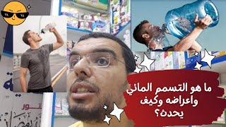 معلومات صادمة قد لا تعرفها! ما هو التسمم المائي واعراضه وكيف يحدث ؟