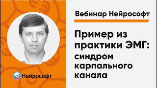 Пример из практики ЭМГ: синдром карпального канала | Вебинар Нейрософт