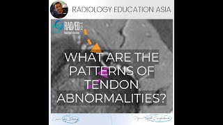 MRI TENDONS: AN EASY PATTERN TO ASSESS