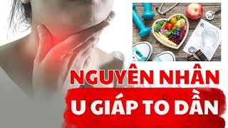 U Tuyến Giáp To Dần: Nguyên Nhân và Cách Ngăn Ngừa | Bác Sĩ Chiều