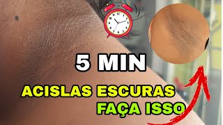 CLAREANDO ACSILAS |RECEITA CASEIRA