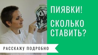 Сколько можно ставить пиявок?