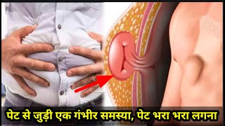 pet bhara bhara lagna | hernia kya hota hai | hiatal hernia | hiatal hernia symptoms and treatment.