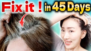 How to Stop Hair Loss and Regrow Hair Color Naturally with Scalp Lymphatic Drainage Massage