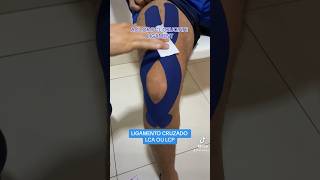 COMO COLOCAR KINESIO NO JOELHO PARA LCA OU LCP #dicas #fisio #kinesiotape #fisioterapia #joelho