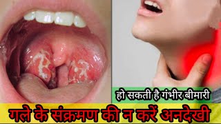 Throat Infection In Hindi | Gale me infection kyu hota hai | symptoms of Throat Infection in Hindi.