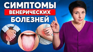 Как понять, что ты ЗАРАЗИЛСЯ? Симптомы венерических заболеваний