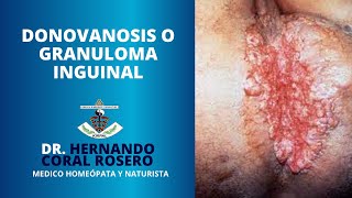 DONOVANOSIS O GRANULOMA INGUINAL