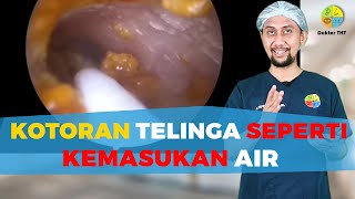 Membersihkan kotorsn telinga seperti kemasukan air | Dokter THT