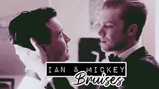 Ian & Mickey - Bruises {10x12/Legendado}