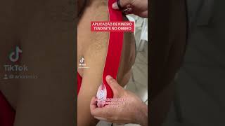 COMO COLOCAR KINESIO NO OMBRO COM TENDINITE #dicas #fisio #kinesiotape #fisioterapia #ombro