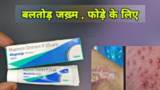 Muprocin Ointment | mupirocin ointment ip uses in hindi Prince Azeemuddin