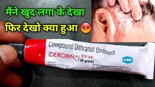 Derobin Cream Uses in Hindi | derobin Cream kis kaam mein ata hai | dad khaj khujli psoriasis