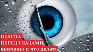 Туман (пелена) перед глазами 👀 причины и лечение