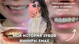 МОЯ ИСТОРИЯ ЗУБОВ | виниры emax, коронки, пломбы и сколько это стоит