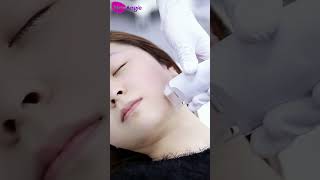 Vacuum roller massage handle for face, to smooth fine lines, face massage