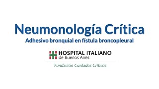 Adhesivo bronquial en tratamiento de fístula broncopleural