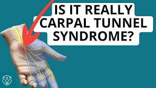 Carpal Tunnel or Neck Radiculopathy: How To Tell The Difference | Aleks Physio