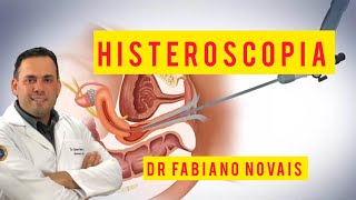 Histeroscopia - saiba o que é esse procedimento