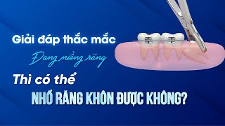 Đang Niềng có nhổ răng khôn được không?