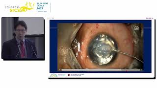 ITA - Management of corneal hydrops - E.Y. Tu (USA)