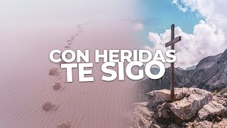 Las heridas y las santidad | Contesto tus dudas