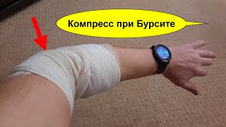 Лечебный компресс при БУРСИТЕ  с алоэ и медицинской желчью  на больной сустав. Бурсит лечение