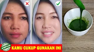 Tips Cara Menghilangkan Flek Hitam Serta Memutihkan dan Menghaluskan Wajah