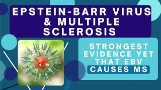 Is Multiple Sclerosis caused by Epstein-Barr? Science says "YES!"