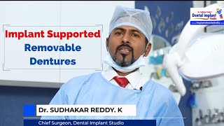 What is Implant Supported Removable Dentures?| Best Dental Implants Bangalore| Dental Implant Studio