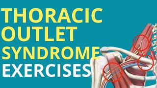 5 Exercises for Thoracic Outlet Syndrome