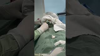 Endometriotic ovarian cyst alcohol ablation