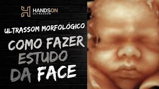 Ultrassom morfológica: Como fazer o estudo da face / Dra. Roberta Severiano / HansdOn ultrassom