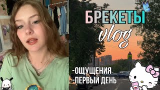 VLOG-ставлю брекеты/покупки/первый день/ощущения🥺