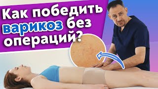 Лечение варикоза без операций! / Как избавиться от варикоза?