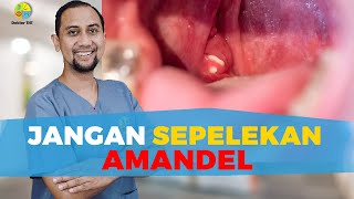 Jangan Sepelekan Amandel | Dokter Tht