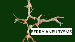 Berry Aneurysms | Circle of Willis | Blood supply of Brain