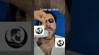 All Skin Hair Remove 😱🔥 clinic #tutorial #shortvideo #viral