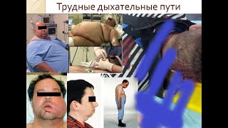 Трудные дыхательные пути часть 1