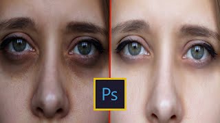 Remove dark circle under the eyes   Photoshop new tutorial