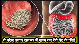 pet ke kide ka ilaj | Home remedy for stomach worms | ये घरेलू उपाय रातभर में खत्म पेट के कीड़े.