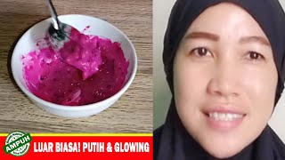 Tips Cara Memutihkan Wajah Serta Menghilangkan Flek Hitam Bekas Jerawat