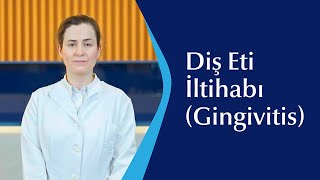 Diş Eti İltihabı (Gingivitis)