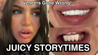 STORYTIME- I Got My Teeth Done..The Results Are HIDEOUS! | Tiktok Compilation