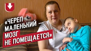 У моего сына микроцефалия: Аня | Быть мамой