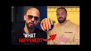 Andrew Tate Reacts To Drake With Painted Nails